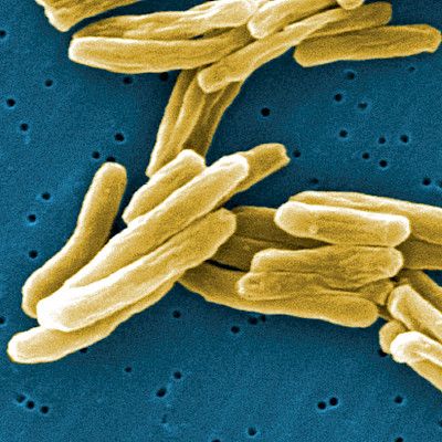 Uusi suositus tuberkuloosin tartunnanjäljitykseen