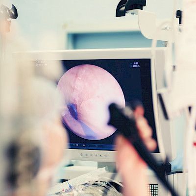 Endoskooppinen ultraääni voi korvata leikkauksen