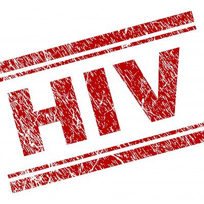 Uusi HIV–variantti johtaa nopeammin AIDS–vaiheeseen