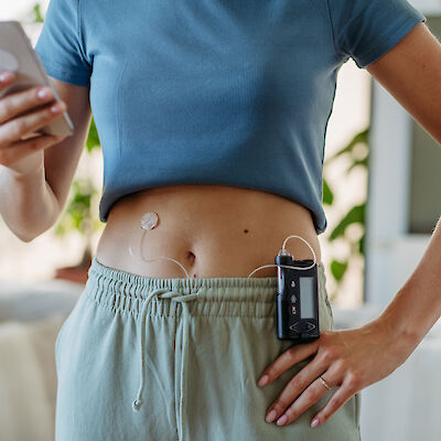 Tutkimus: Älyinsuliinipumppu kustannustehokas tyypin 1 diabeteksen hoidossa