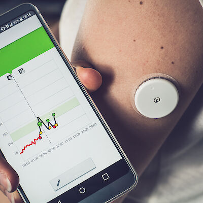 Kaikki diabetesta sairastavat hyötyisivät glukoosisensorista
