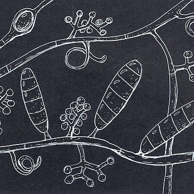 Sienilääkeresistenssi yleistyy – valppautta tarvitaan