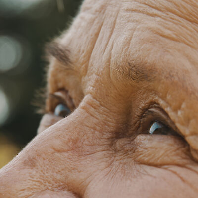 Kuvantamislöydösten merkitys ja ymmärrys korostuvat silmätautien hoidossa