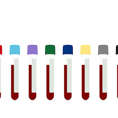 Voiko diabeteksen puhkeamista estää suun kautta annostellulla insuliinilla?