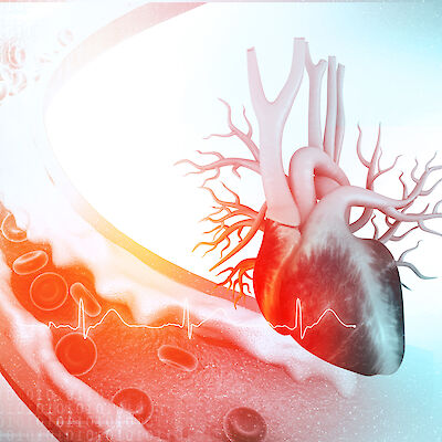 Pitkäaikaissairauksien riskitekijät tulee saada hallintaan