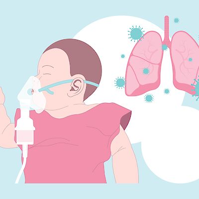 Lasten hengenahdistuksen hoidossa käytettävien laitteiden tehoissa on eroja