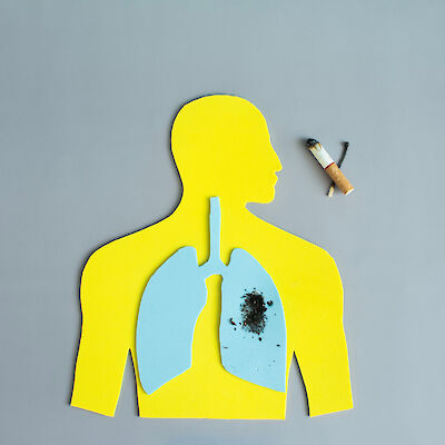 Keneltä seuloa keuhkosyöpää?