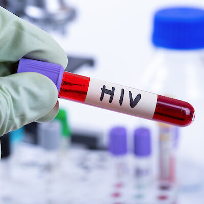 Suomessa on hyvät hivin hoitotulokset