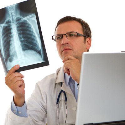 COPD-potilaiden kuolleisuuteen vaikuttavat nikotiinireseptorigeenin eri muodot