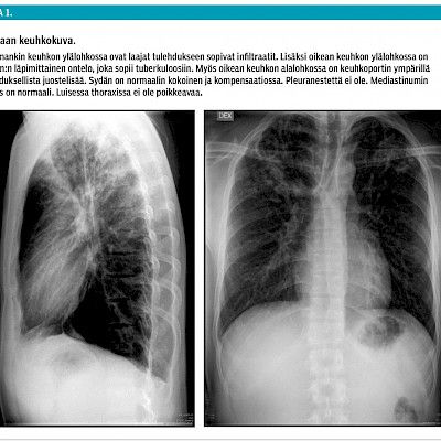 Nuoren opiskelijan ongelmat – osa 2