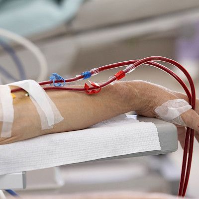 Uremian aktiivi­hoitojen vähyys ihmetyttää