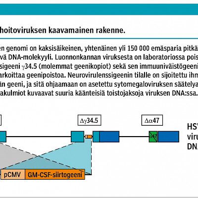 Onkolyyttinen geenihoitovirus tulossa osaksi ihomelanooman lääkehoitoa