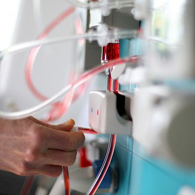 Tukihoidon ajoitus akuutissa  munuaisten vajaatoiminnassa