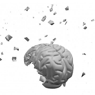 Löytyykö mikrobeista  selitys Alzheimerin tautiin?