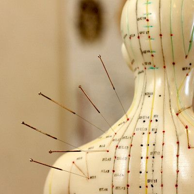Lääkärit suhtautuvat kriittisesti uskomushoitoihin