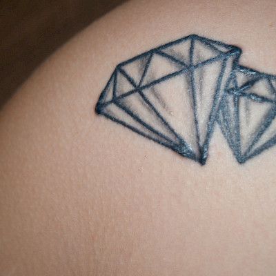 Tatuointien komplikaatiot