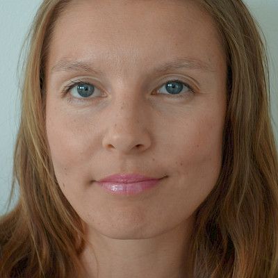 Ihmisen kantasoluilla on potentiaalia vaikeiden luunmurtumien hoidossa