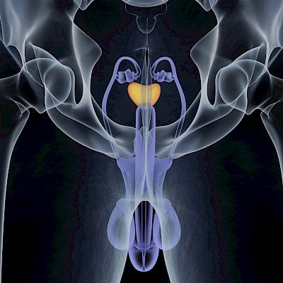 Säästääkö magneettikuva eturauhasen biopsialta?