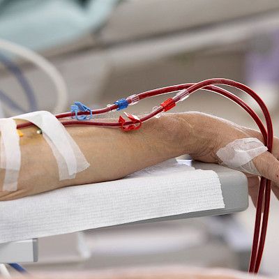 Yhä useampi sai dialyysihoitoa