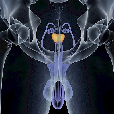 Säästääkö magneettikuva eturauhasen biopsialta?