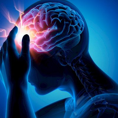 Epilepsian kehittyminen aisoihin uuden löydön avulla