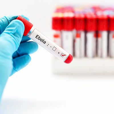 Epidemiavarautuminen ontuu