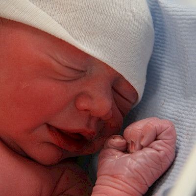 Potilasvahingot ovat harvinaisia synnytyksissä