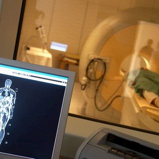 Magneettikuvaus on turvallinen valtaosalle tahdistinpotilaista
