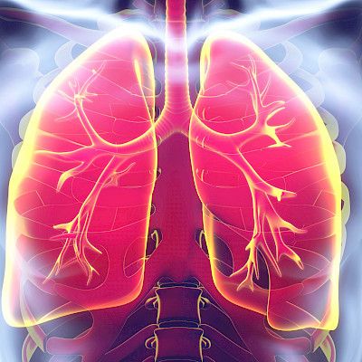 Keuhkosyövän oireisiin tarvitaan lievitystä loppuun asti