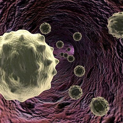 Sepsiksen laboratoriodiagnostiikan avain voi löytyä valkosolujen pinnalta