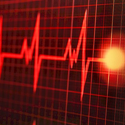 Hypotermiahoito voi auttaa sydänpysähdyksen jälkeen