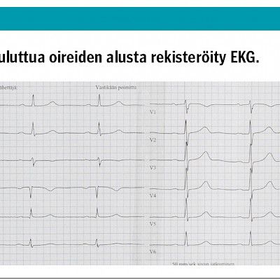 Kliininen kysymys: Nuoren miehen rinnan kolahtelu