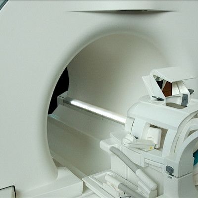 Magneettikuvauksesta ei ole hyötyä tuoreen nilkkamurtuman hoidossa