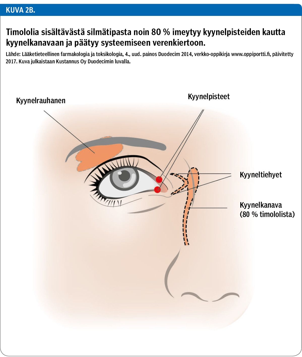 Timololia sisältävästä silmätipasta noin 80 % imeytyy kyynelpisteiden kautta kyynelkanavaan ja päätyy systeemiseen verenkiertoon.