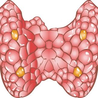 Kilpirauhanen oireilee:  tyreoidiittien diagnostiikka ja hoito