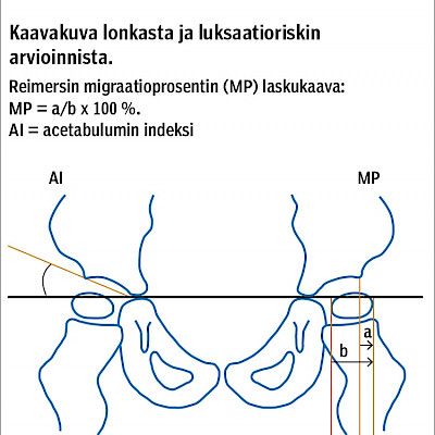 CP-lasten ja -nuorten systemaattinen lonkkaseuranta puuttuu Suomesta