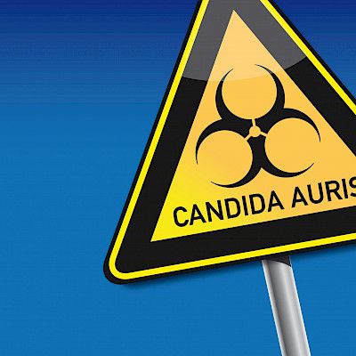 Candida auris aiheuttaa laajoja epidemioita Euroopassa
