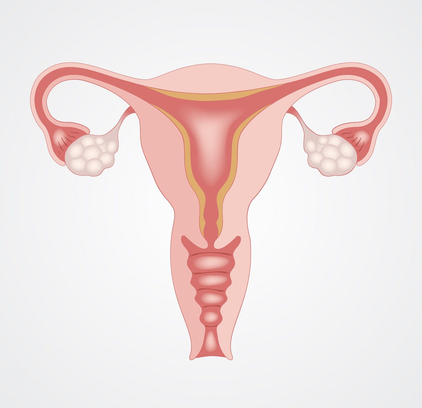 Valvira Essureimplanttien poistotoimenpiteitä varten tutustuttava
