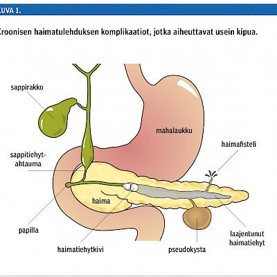 Kroonisen haimatulehduksen diagnostiikka ja hoito