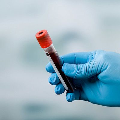 Pitääkö ferritiinipitoisuus tutkia neuvolassa?