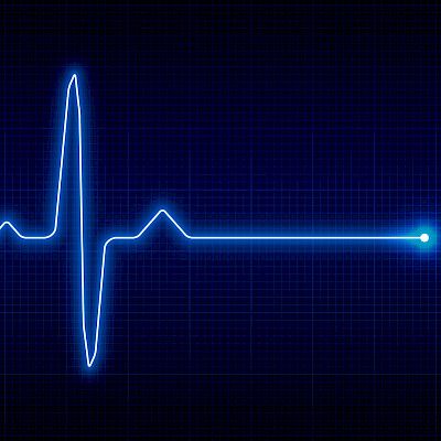 Defibrillaattoriliivi pettymys  sydäninfarkti­potilaan äkkikuoleman ehkäisyssä