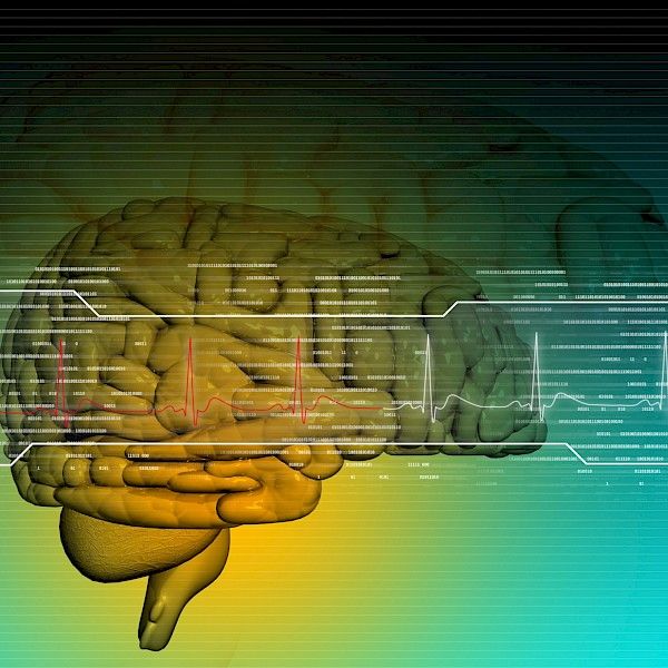 Muistitestit ennustavat aivojen surkastumista ja Alzheimerin tautiin sairastumista