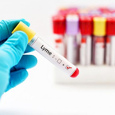 EU-päätöslauselma hämmentää Lymen borrelioosin hoitoa