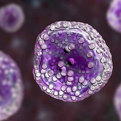 CAR-T-hoidoilla saavutettiin B-solulymfooman hoidossa parempia hoitovasteita