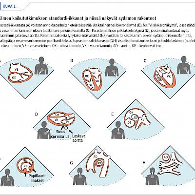 Lapsen sydämen ultraäänidiagnostiikka