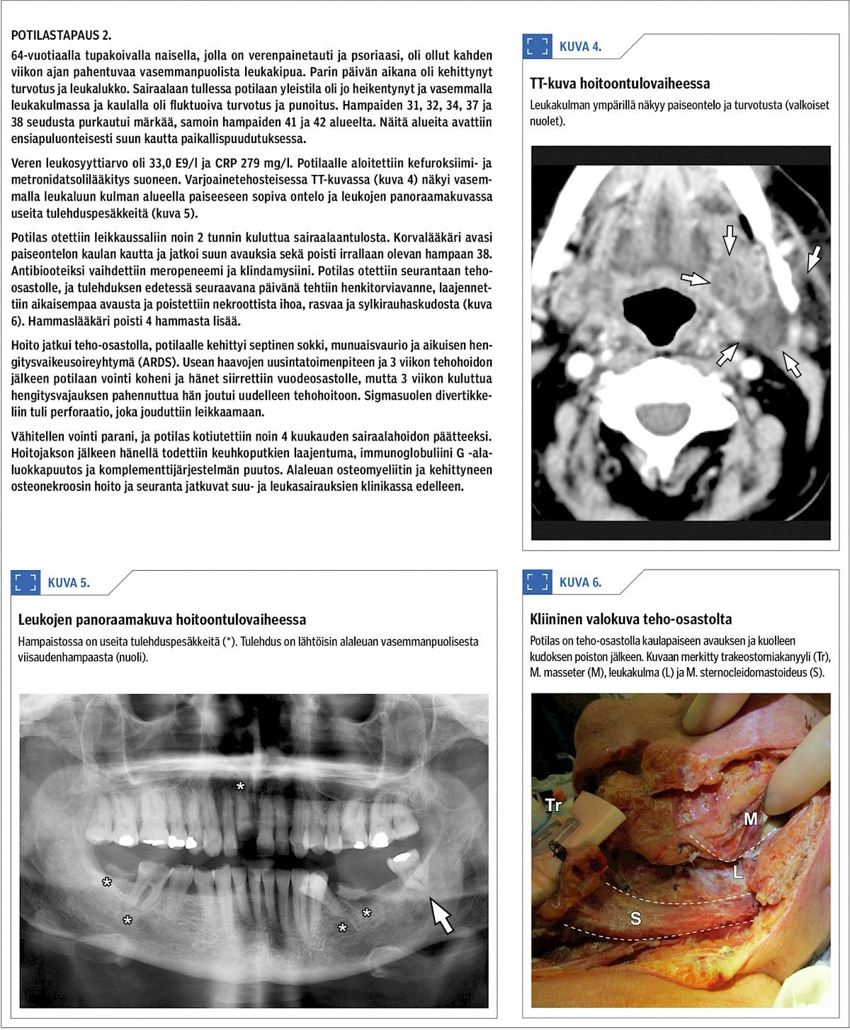 Potilastapaus 2.