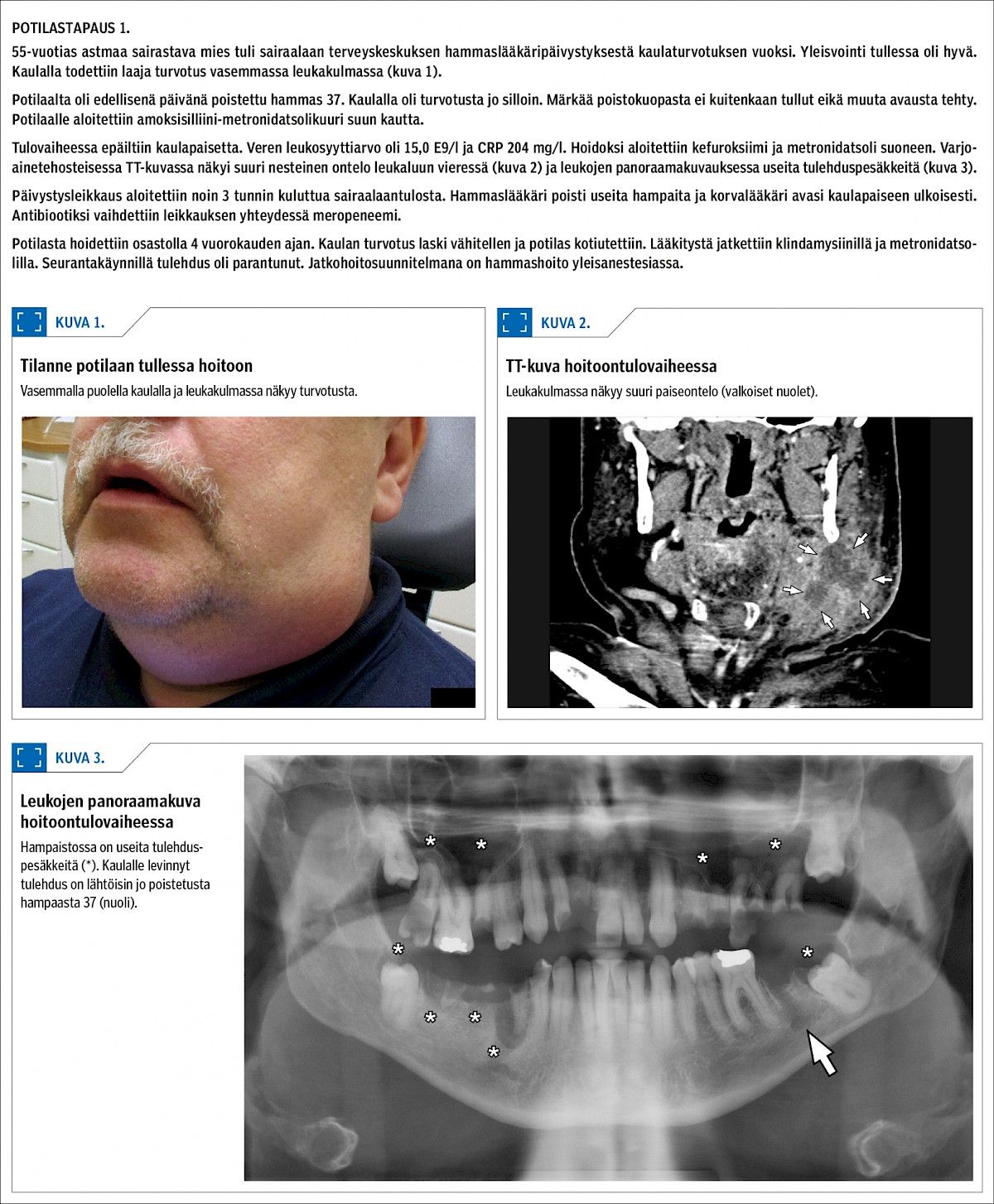 Potilastapaus 1.