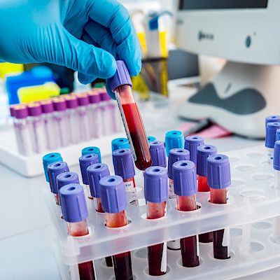 Eksote selvittää laboratoriotoiminnan myynnin edellytyksiä