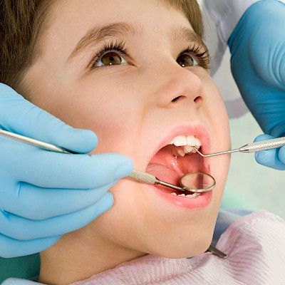 Hampaiden reikiintyminen ja ientulehdus lapsuudessa saattavat lisätä valtimokovettumataudin riskiä