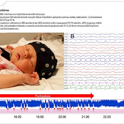 Lasten kliinisen neurofysiologian tutkimuskäytännöt